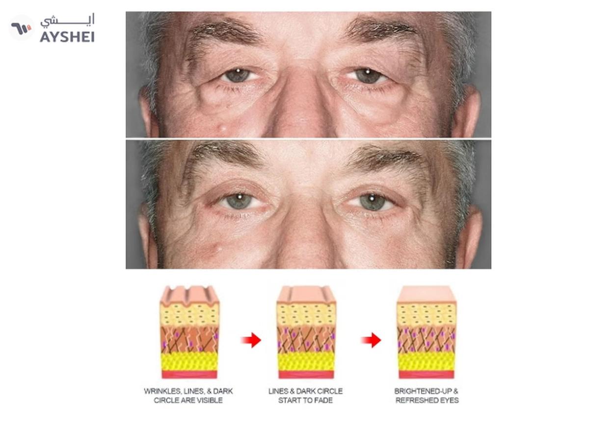 East Moon East Moon Men's Cool Tender Eye Cream-3-3